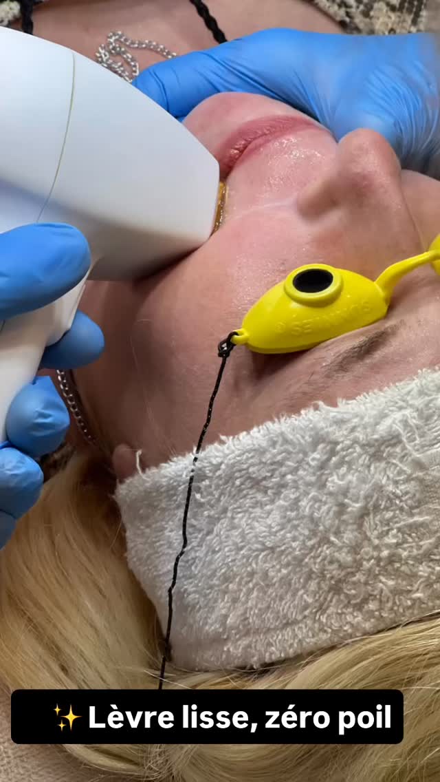 💡 Marre de la cire, du rasoir ou des crèmes ?
👉 Le laser dit STOP aux poils sur la lèvre supérieure !
Résultat : peau lisse, nette ✨ et sans retouches.
La saison du laser est ouverte 🎆

#sparueontariomontreal #bestfacialmontreal #lasermontreal #laserblackskinmontreal #laserhairemovalmontreal #bodyspamontreal