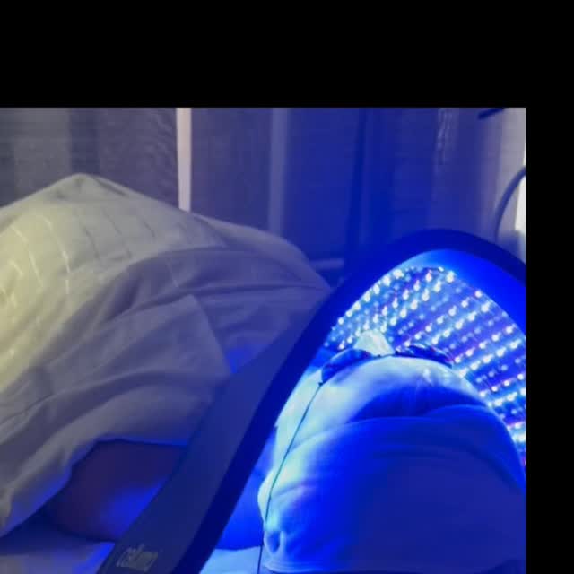 ☀️ Aujourd’hui, ma #sparueontariomontreal #bestfacialmontreal #lasermontreal #montrealspa #esthéticiennemontréal #facialmontreal #spamontreal #iplmontreal #acnetreatments #facemassagemontreal #sparueontariomontreal cliente est venue avec un petit coup de soleil.
Par sécurité, je n’ai pas pu réaliser son traitement au laser, car la peau devient plus fragile après une exposition solaire.

👉 À la place, j’ai opté pour une autre thérapie douce et sécuritaire, afin de protéger et respecter sa peau. 💆‍♀️✨

La priorité reste toujours : la santé et la sécurité de votre peau. 💖