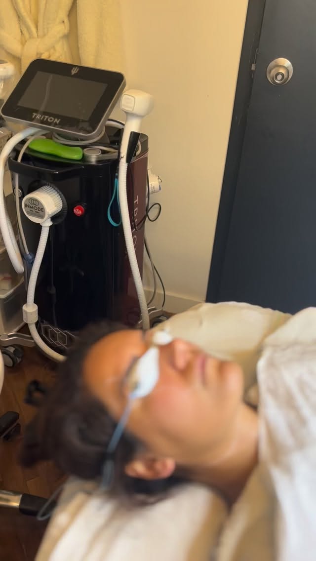 Let’s talk about laser hair removal on the upper lip . This area is very sensitive. 
1. We notice often clients with hyperpigmentation due to a lot of reasons:  hormonal changes , too much waxing and traumatic redness followed by dark spots, luck of sunscreen because of sweat, dry nostrils and sensitive areas during a cold, dry lips during extreme weather or luck of moisturizer, teenage acne… . Lots of factors contribute to upper lip hyperpigmentation! 
2 . The unwanted hair on the upper lip is thin , we are aware that is dark but the hair follicles are small! 
3. The surface area is small and hard to reach with the hand piece.
All this should be discussed and evaluated during the consultation.

We will give you our honest feedback and suggest you the best way to get rid of this problem. Book on line for a free consultation. 

Bodyspa.ca