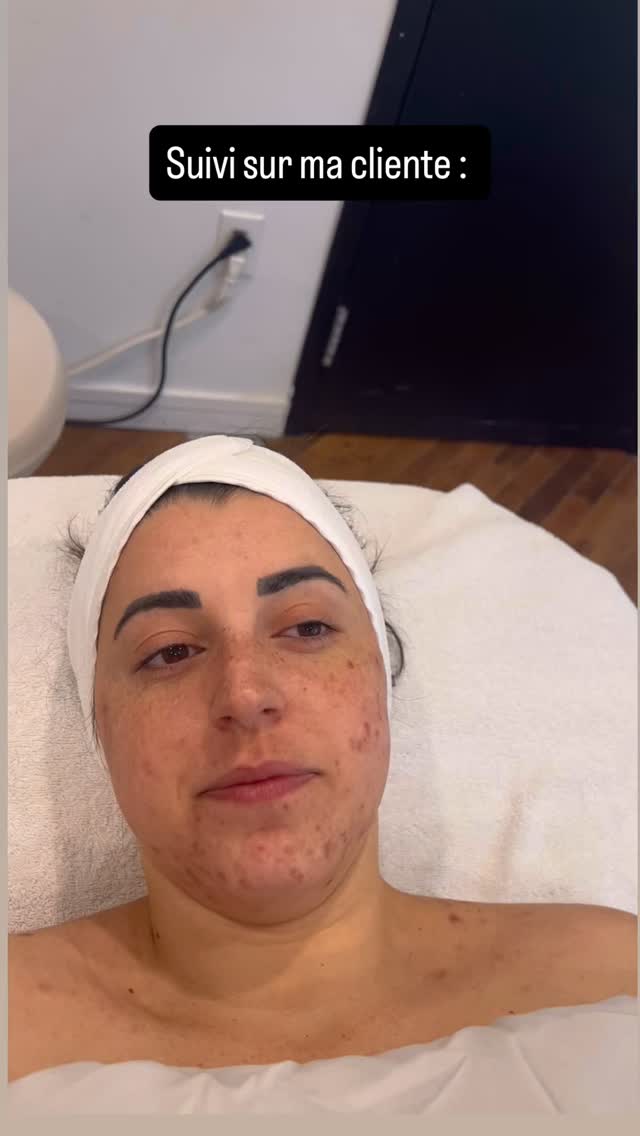 Voilà une cliente courageuse! 🤍👏👏👏