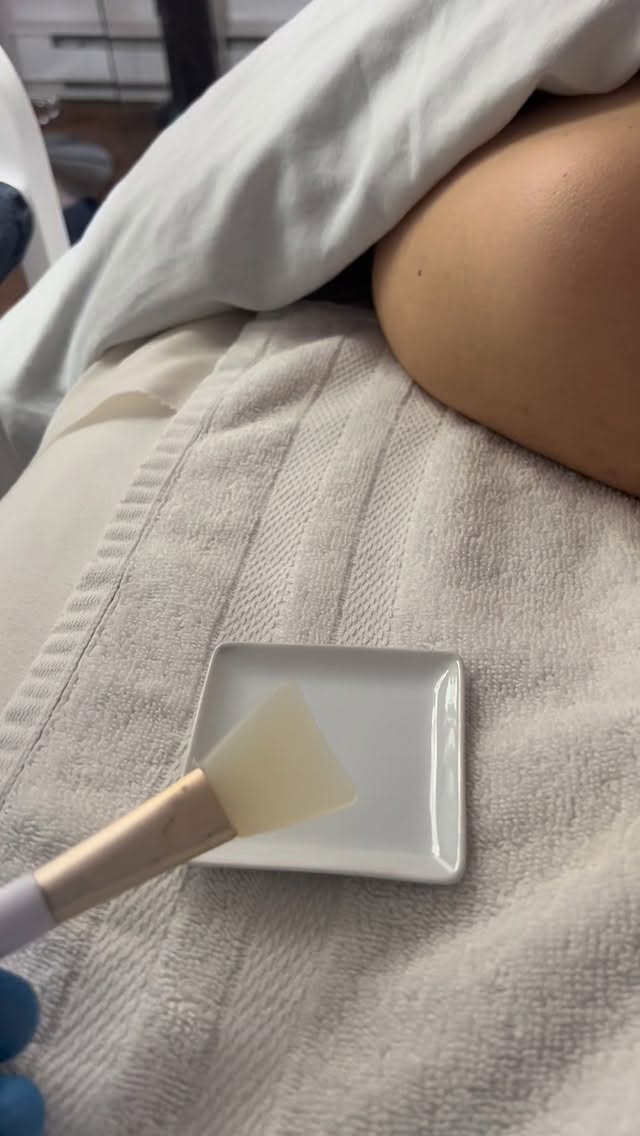 Glowy skin starts long before the facial begins ✨

Every peel I prepare is custom — chosen with care based on your skin type, the season, and everything your skin has been through.

It’s a blend of science, experience… and a little intuition magic 💫

In just 90 minutes, we create more than a facial — we create a moment where your skin gets exactly what it needs to glow, heal, and feel its absolute best.

Because no two skins are the same… and yours deserves that level of attention 🤍