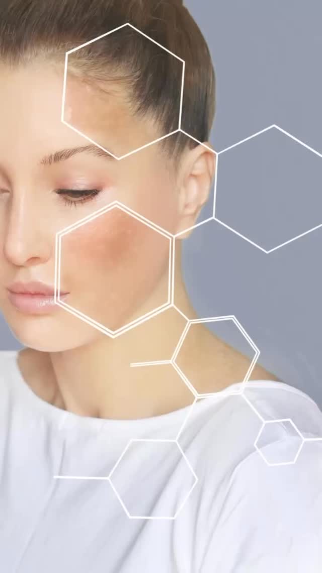 ✨ Il existe 4 types de peau… et connaître le tien change tout !

Peau sèche, peau grasse, peau mixte ou peau sensible :
chaque type de peau a des besoins bien spécifiques.

Le problème ?
Beaucoup de personnes utilisent des produits qui ne sont pas adaptés à leur peau…
et se retrouvent avec des résultats décevants (ou pire, des déséquilibres).

💡 La clé, c’est le diagnostic.

Comprendre ta peau, c’est pouvoir lui donner exactement ce dont elle a besoin. Ni plus, ni moins.

Une routine efficace ne se choisit pas au hasard, elle se construit sur mesure.

Si tu ne sais pas quel est ton type de peau, je peux t’aider à y voir plus clair ✨

📍 Montréal
💌 Écris-moi en DM ou réserve ton soin via le lien en bio

#skincaretips #typedepeau #soinvisage #estheticiennemontreal #skincaremtl peausaine